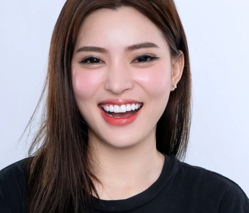 Bọc răng sứ mất bao lâu? - Chỉ khoảng 3 - 5 ngày